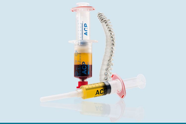 ACP-Therapie