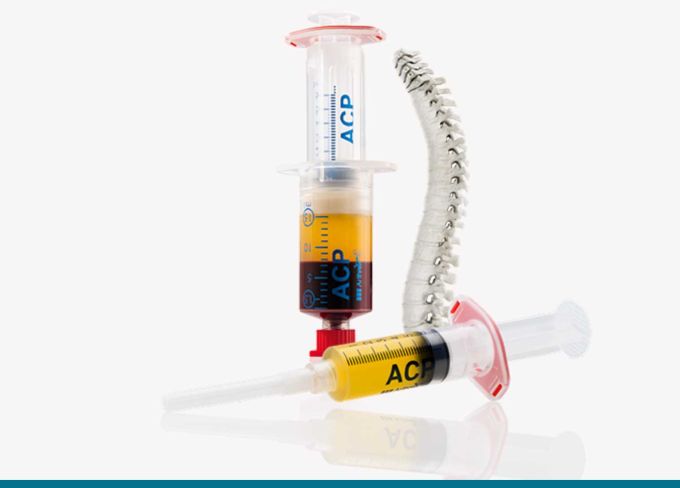 ACP Therapie